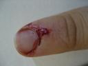 Bloody Finger of Death